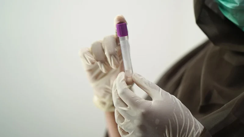 Opłaty za badania laboratoryjne – Co powinieneś wiedzieć
